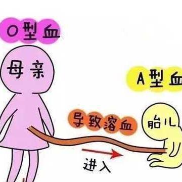 ABO溶血会怎么样