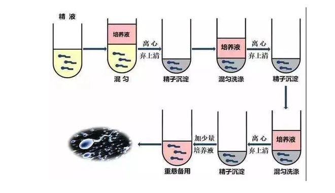 试管三代流程和时间