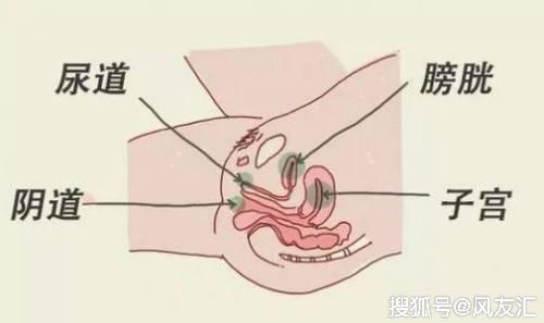 女性尿路感染用什么药比较好