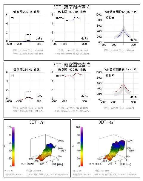 钛合金拉伸曲线