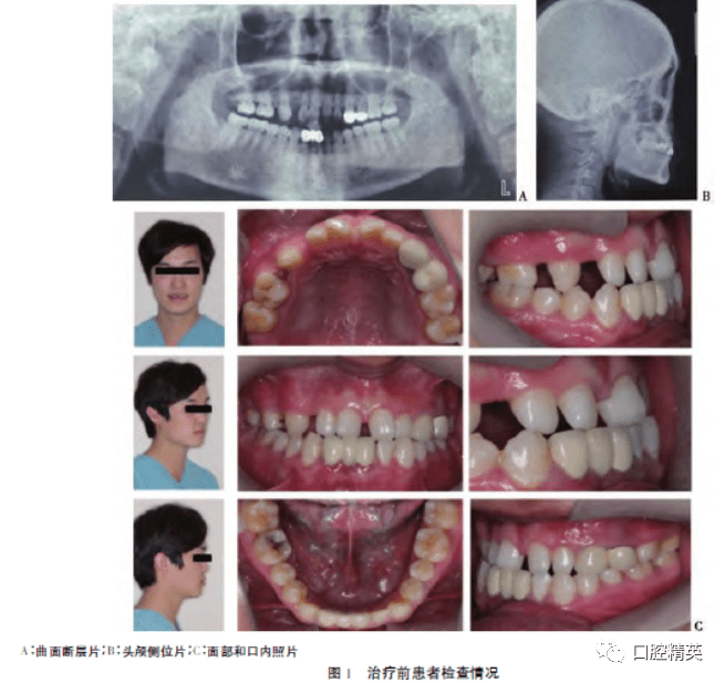 下颌正畸手术,关于下颌正畸手术的整体讲解规划与流程,迅速执行计划设计_mShop18.84.46